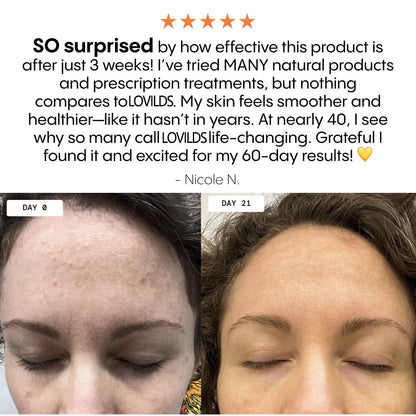 💥Last Day Promotion 80% OFF 🔥Vastlyo® The Complete System for Mature Women’s Skin