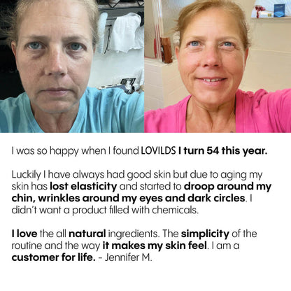 💥Last Day Promotion 80% OFF 🔥Vastlyo® The Complete System for Mature Women’s Skin