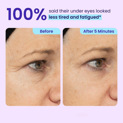 Vastlyo® Elvara Instant Eye Lifting Gel – Up to 80% Off | Firm, Smooth & Refresh Tired-Looking Eyes