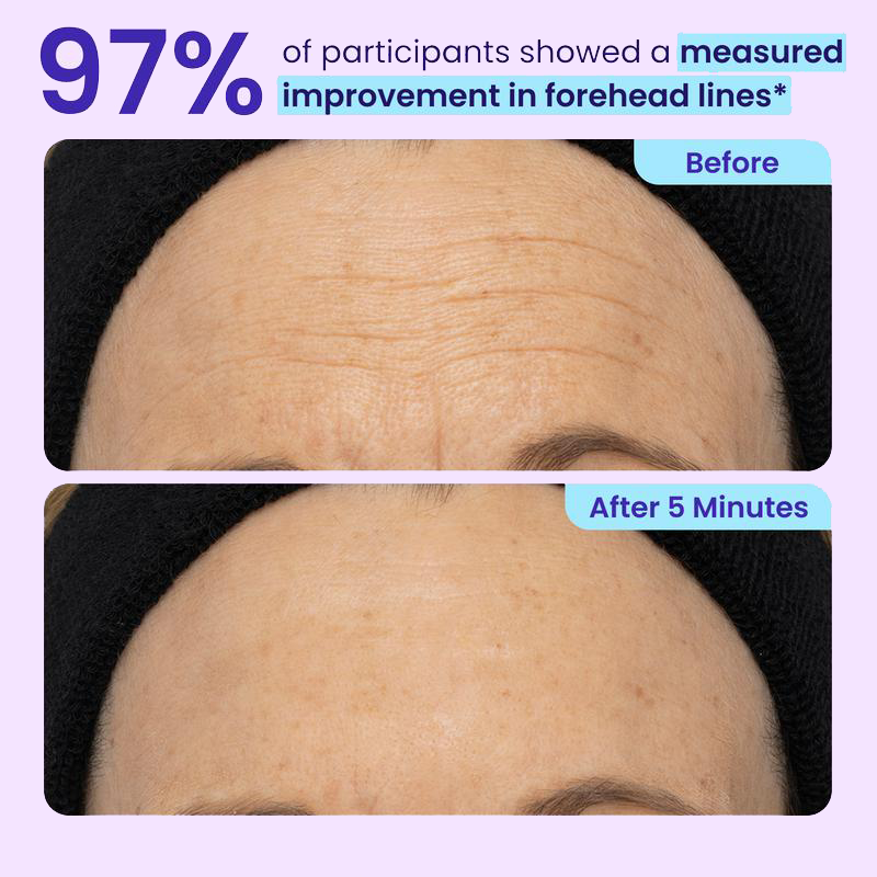Vastlyo® Elvara Instant Eye Lifting Gel – Up to 80% Off | Firm, Smooth & Refresh Tired-Looking Eyes