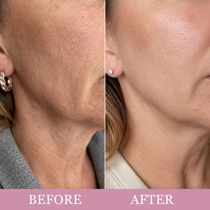 🦢 Neck Wrinkle Eraser Cream with Built-In Gua Sha Massager 5% Anemarrhena Root Complex + PDRN | Korean Skincare